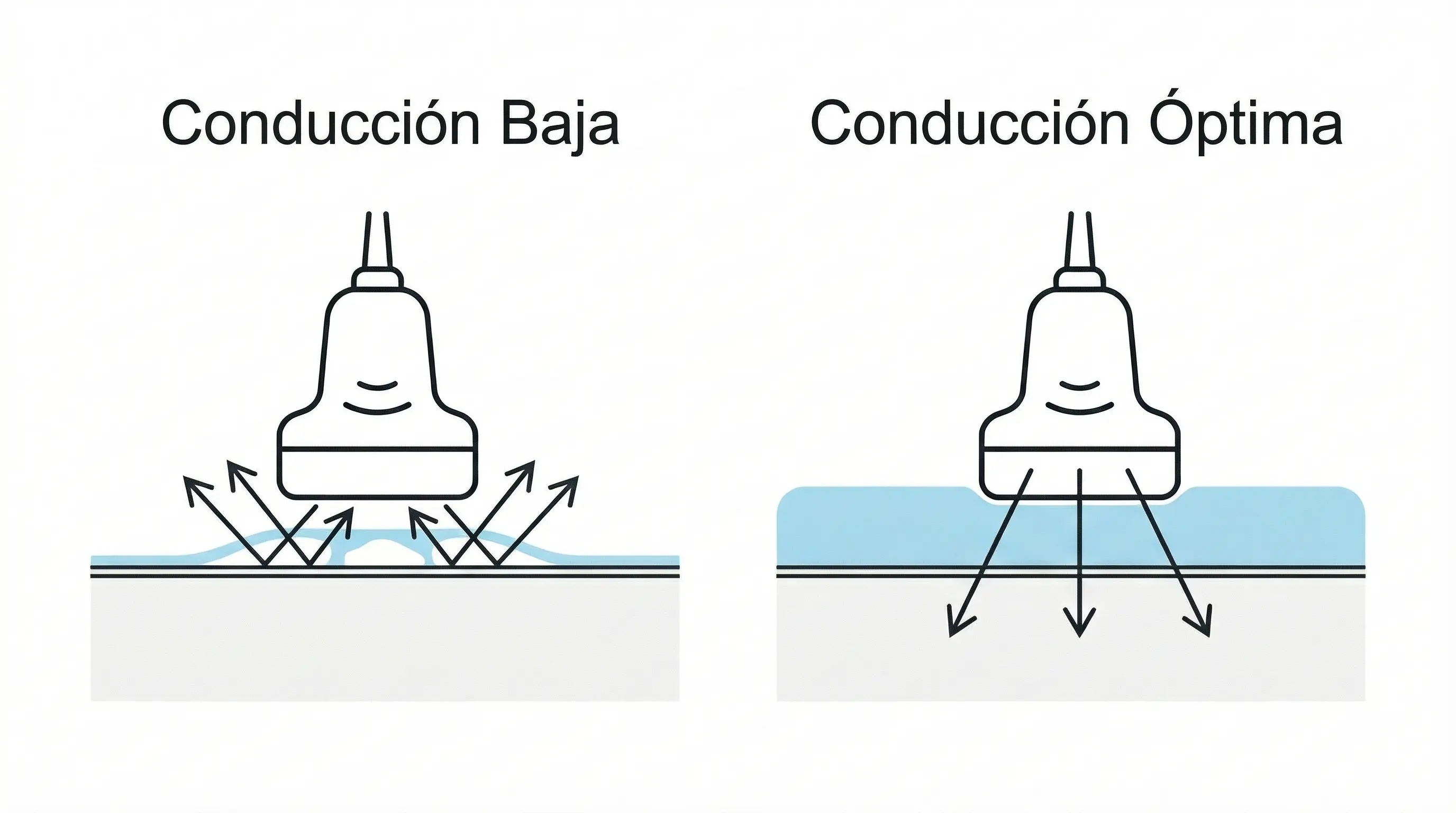 Imagen ilustrativa sobre gel conductor neutro 5kg mercado libre: los mejor valorados envío full